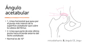 Medidas Radiologicas Cadera.pptx