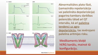 Medikamentu inducēts QT intervāla pagarināšanās. Laura Sviklāne. | PPT