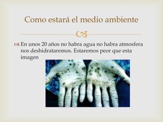 
 En unos 20 años no habra agua no habra atmosfera
nos deshidrataremos. Estaremos peor que esta
imagen
Como estará el medio ambiente
 