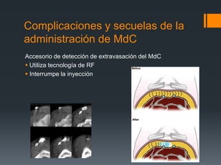Complicaciones y secuelas de la
administración de MdC
Accesorio de detección de extravasación del MdC
 Utiliza tecnología de RF
 Interrumpe la inyección
 