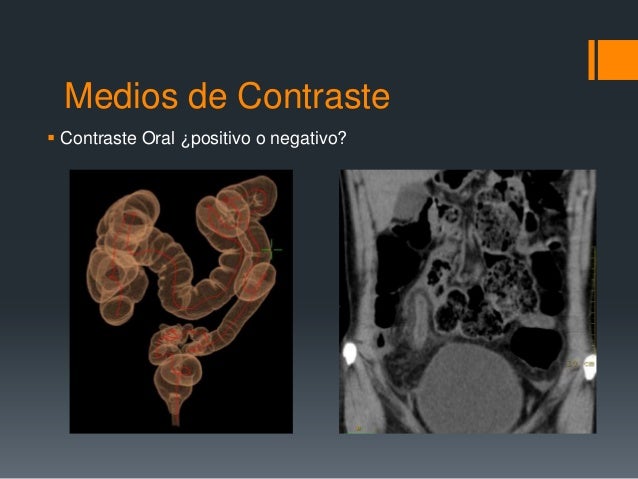 Resultado de imagen para medios de contraste POSITIVO Y NEGATIVO
