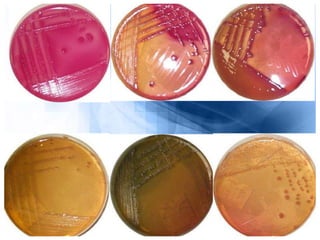 Resultados
Observar las características de las colonias y realizar las pruebas de
identificación de microorganismos.
1-Fer...
