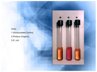 Medios de-cultivo-y-pruebas-bioquimica-1225658128608610-9