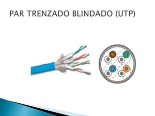 MEDIOS DE CONEXION...!