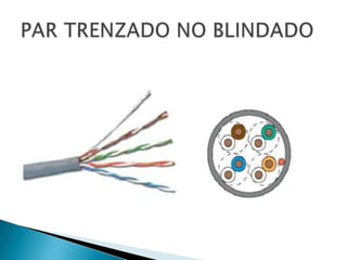 MEDIOS DE CONEXION...!