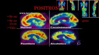 POSITRONES
• Se emplean en PET.
• Se emplean radiofármacos: 18-FDG, carbono 11 y nitrógeno
13 entre otros.
• Vida media corta.
 