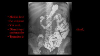 METILCELULOSA
• Medio de contraste neutro.
• Se utilizan con agua.
• Vía oral.
• Disminuyen la reabsorción de agua en la luz intestinal,
mejorando la distensión.
• Transito intestinal.
 