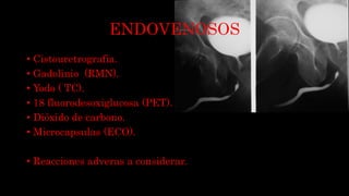 ENDOVENOSOS
• Cistouretrografia.
• Gadolinio (RMN).
• Yodo ( TC).
• 18 fluorodesoxiglucosa (PET).
• Dióxido de carbono.
• Microcapsulas (ECO).
• Reacciones adveras a considerar.
 
