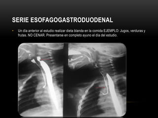 SERIE ESOFAGOGASTRODUODENAL
• Un día anterior al estudio realizar dieta blanda en la comida EJEMPLO: Jugos, verduras y
frutas. NO CENAR. Presentarse en completo ayuno el día del estudio.
 