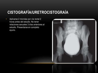 CISTOGRAFÍA/URETROCISTOGRAÍA
• Aplicarse 2 microlax por vía rectal 2
horas antes del estudio. No tener
relaciones sexuales 3 días anteriores al
estudio. Presentarse en completo
ayuno.
 
