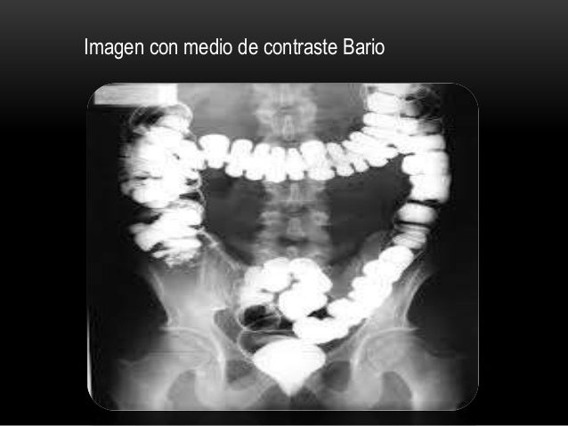 Resultado de imagen para medios de contraste en radiologia