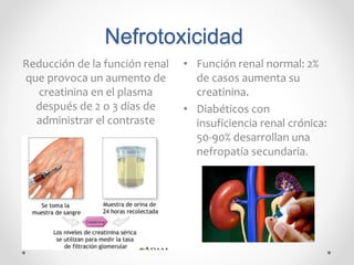 Nefrotoxicidad
Reducción de la función renal
que provoca un aumento de
creatinina en el plasma
después de 2 o 3 días de
administrar el contraste
• Función renal normal: 2%
de casos aumenta su
creatinina.
• Diabéticos con
insuficiencia renal crónica:
50-90% desarrollan una
nefropatía secundaria.
 