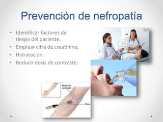 Prevención de nefropatía
• Identificar factores de
riesgo del paciente.
• Emplear cifra de creatinina.
• Hidratación.
• Reducir dosis de contraste.
 