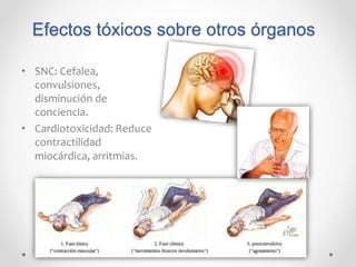 Efectos tóxicos sobre otros órganos
• SNC: Cefalea,
convulsiones,
disminución de
conciencia.
• Cardiotoxicidad: Reduce
contractilidad
miocárdica, arritmias.
 