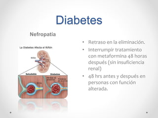 Diabetes
Nefropatía
• Retraso en la eliminación.
• Interrumpir tratamiento
con metaformina 48 horas
después (sin insuficiencia
renal)
• 48 hrs antes y después en
personas con función
alterada.
 