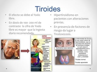 Tiroides
• El efecto se debe al Yodo
libre.
• En dosis de 100- 200 ml de
contraste la cifra de Yodo
libre es mayor que la ingesta
diaria recomendada.
• Hipertiroidismo en
pacientes con alteraciones
previas.
• En presencia de factores de
riesgo da lugar a
Tirotoxicosis.
 