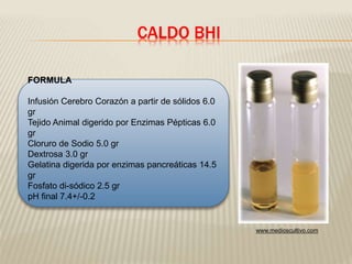 CALDO BHI 
FORMULA 
Infusión Cerebro Corazón a partir de sólidos 6.0 
gr 
Tejido Animal digerido por Enzimas Pépticas 6.0 
gr 
Cloruro de Sodio 5.0 gr 
Dextrosa 3.0 gr 
Gelatina digerida por enzimas pancreáticas 14.5 
gr 
Fosfato di-sódico 2.5 gr 
pH final 7.4+/-0.2 
www.medioscultivo.com 
 