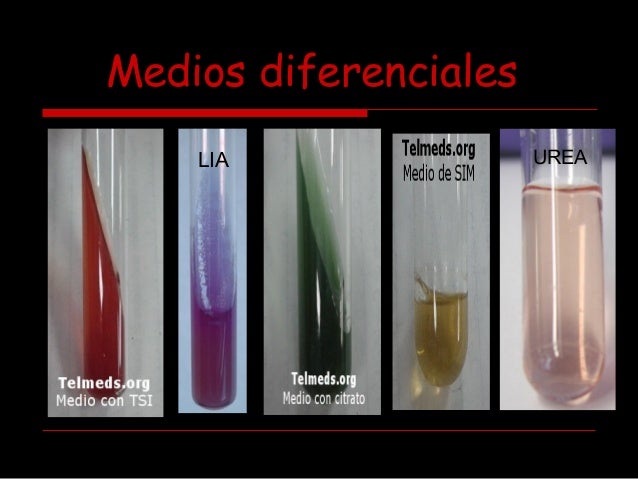 Medios de cultivo diferenciales