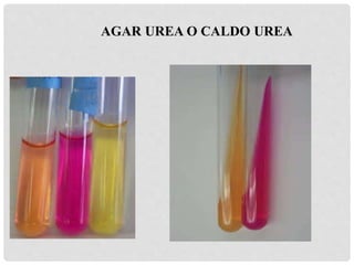 AGAR UREA O CALDO UREA
 