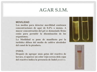 AGAR S.I.M.
MOVILIDAD
Los medios para detectar movilidad contienen
concentraciones de agar de 0.4% o menos. A
mayor concentración del gel es demasiado firme
como para permitir la diseminación de los
organismos.
La Motilidad se pone de manifiesto por la
turbidez difusa del medio de cultivo alrededor
del canal de la picadura.
INDOL
Después de agregar unas gotas del reactivo de
kovacs, si aparece un color rojo-cereza dela capa
del reactivo indica la presencia de Indol positivo.
 