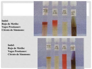 I.M.V.I.C.
Indol:
Rojo de Metilo:
Voges Proskauer:
Citrato de Simmons:
Indol:
Rojo de Metilo:
Voges Proskauer:
Citrato de Simmons:
 