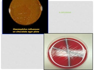 H. INFLUENZAE
 