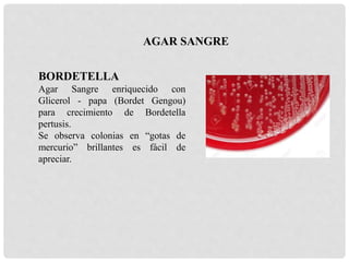 BORDETELLA
Agar Sangre enriquecido con
Glicerol - papa (Bordet Gengou)
para crecimiento de Bordetella
pertusis.
Se observa colonias en “gotas de
mercurio” brillantes es fácil de
apreciar.
AGAR SANGRE
 