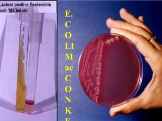 E.
C
O
LI
M
ac
C
O
N
K
 