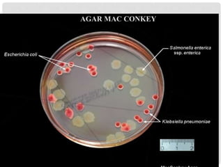 AGAR MAC CONKEY
 