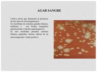 Cultivo mixto que demuestra la presencia
de dos tipos de microorganismos:
Un morfotipo de colonias grandes blancas,
brillantes y con bordes irregulares
pertenecientes a bacilos gramnegativos.
El otro morfotipo presenta colonias
blancas, pequeñas, enteras, típicas de un
microorganismo Gram positivo.
AGAR SANGRE
 