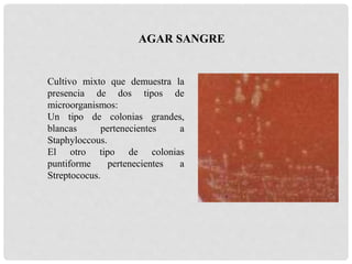 Cultivo mixto que demuestra la
presencia de dos tipos de
microorganismos:
Un tipo de colonias grandes,
blancas pertenecientes a
Staphyloccous.
El otro tipo de colonias
puntiforme pertenecientes a
Streptococus.
AGAR SANGRE
 