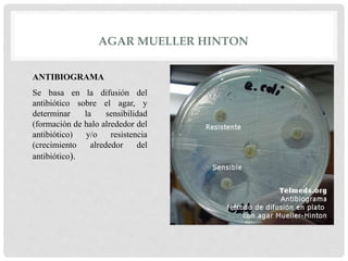AGAR MUELLER HINTON
ANTIBIOGRAMA
Se basa en la difusión del
antibiótico sobre el agar, y
determinar la sensibilidad
(formación de halo alrededor del
antibiótico) y/o resistencia
(crecimiento alrededor del
antibiótico).
 