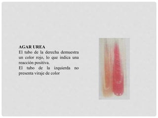 AGAR UREA
El tubo de la derecha demuestra
un color rojo, lo que indica una
reacción positiva.
El tubo de la izquierda no
presenta viraje de color
 