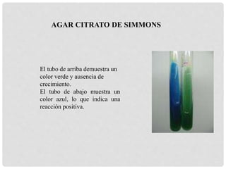 El tubo de arriba demuestra un
color verde y ausencia de
crecimiento.
El tubo de abajo muestra un
color azul, lo que indica una
reacción positiva.
AGAR CITRATO DE SIMMONS
 