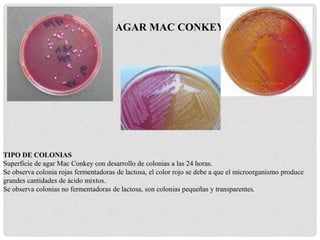 AGAR MAC CONKEY
TIPO DE COLONIAS
Superficie de agar Mac Conkey con desarrollo de colonias a las 24 horas.
Se observa colonia rojas fermentadoras de lactosa, el color rojo se debe a que el microorganismo produce
grandes cantidades de ácido mixtos.
Se observa colonias no fermentadoras de lactosa, son colonias pequeñas y transparentes.
 
