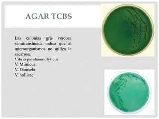 AGAR TCBS
Las colonias gris verdosa
semitranslúcida indica que el
microorganismos no utiliza la
sacarosa.
Vibrio parahaemolyticus
V. Mimicus.
V. Damsela
V. hollisae
 