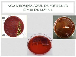 AGAR EOSINA AZUL DE METILENO
(EMB) DE LEVINE
 