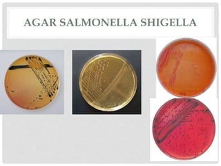 AGAR SALMONELLA SHIGELLA
 