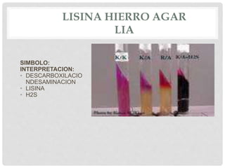 LISINA HIERRO AGAR
LIA
SIMBOLO:
INTERPRETACION:
• DESCARBOXILACIO
NDESAMINACION
• LISINA
• H2S
 