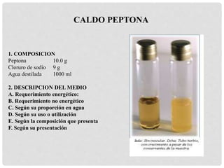 1. COMPOSICION
Peptona 10.0 g
Cloruro de sodio 9 g
Agua destilada 1000 ml
2. DESCRIPCION DEL MEDIO
A. Requerimiento energético:
B. Requerimiento no energético
C. Según su proporción en agua
D. Según su uso o utilización
E. Según la composición que presenta
F. Según su presentación
CALDO PEPTONA
 
