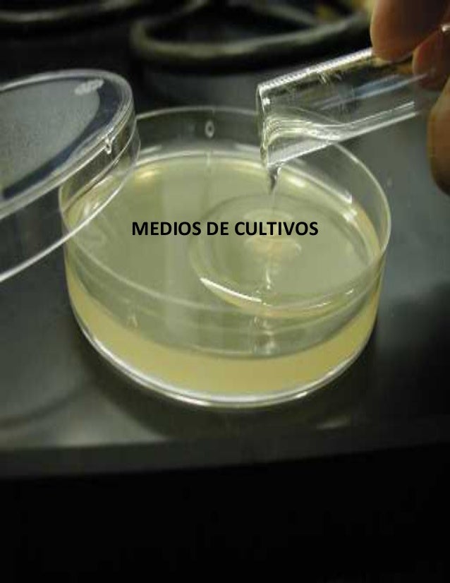 Medios de cultivo.