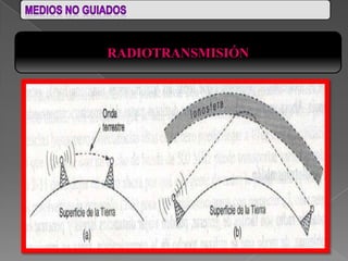 RADIOTRANSMISIÓN
 
