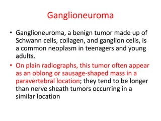 Ganglioneuroma
• Ganglioneuroma, a benign tumor made up of
Schwann cells, collagen, and ganglion cells, is
a common neoplasm in teenagers and young
adults.
• On plain radiographs, this tumor often appear
as an oblong or sausage-shaped mass in a
paravertebral location; they tend to be longer
than nerve sheath tumors occurring in a
similar location
 