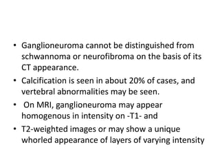 • Ganglioneuroma cannot be distinguished from
schwannoma or neurofibroma on the basis of its
CT appearance.
• Calcification is seen in about 20% of cases, and
vertebral abnormalities may be seen.
• On MRI, ganglioneuroma may appear
homogenous in intensity on -T1- and
• T2-weighted images or may show a unique
whorled appearance of layers of varying intensity
 