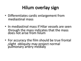 Hilum overlay sign
• Differentiates cardic enlargement from
mediastinal mass
• In mediastinal mass if Hilar vessels are seen
through the mass indicates that the mass
does not arise from hilum
• For accuracy the film should be true frontal
,slight obliquity may project normal
pulmonary artery medialy
 