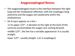 Azygoesophageal Recess
• The azygoesophageal recess is the interface between the right
lung and the mediastinal reflection, with the esophagus lying
anteriorly and the azygos vein posteriorly within the
mediastinum.
• On X-ray,it appears as a line –
- in its upper 1/3rd , it deviates to the right at the level of the
carina to accommodate the azygos vein arching forward.
- middle 1/3rd , the line has a variable appearance: It is usually
straight.
- lower 1/3rd , usually straight. ( air in esophagus)
 