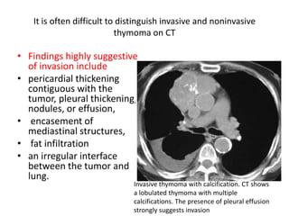 It is often difficult to distinguish invasive and noninvasive
thymoma on CT
• Findings highly suggestive
of invasion include
• pericardial thickening
contiguous with the
tumor, pleural thickening,
nodules, or effusion,
• encasement of
mediastinal structures,
• fat infiltration
• an irregular interface
between the tumor and
lung.
Invasive thymoma with calcification. CT shows
a lobulated thymoma with multiple
calcifications. The presence of pleural effusion
strongly suggests invasion
 