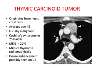 THYMIC CARCINOID TUMOR
• Originates from neural
crest cells.
• Average age 45
• Usually malignant
• Cushing's syndrome in
25%-40%
• MEN in 20%
• Mimics thymoma
radiographically
• Dense enhancement
possibly seen on CT
 