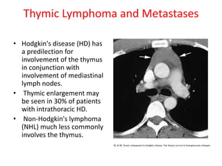 Thymic Lymphoma and Metastases
• Hodgkin's disease (HD) has
a predilection for
involvement of the thymus
in conjunction with
involvement of mediastinal
lymph nodes.
• Thymic enlargement may
be seen in 30% of patients
with intrathoracic HD.
• Non-Hodgkin's lymphoma
(NHL) much less commonly
involves the thymus.
 