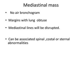 Mediastinal mass
• No air bronchogram
• Margins with lung obtuse
• Mediastinal lines will be disrupted.
• Can be associated spinal ,costal or sternal
abnormalities
 